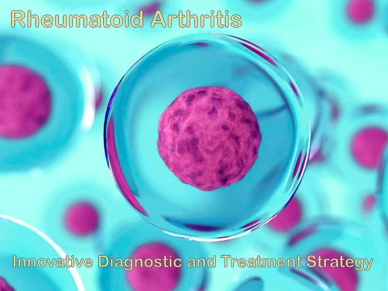 Innovative Strategy for Diagnosis and Treatment of Rheumatoid Arthritis