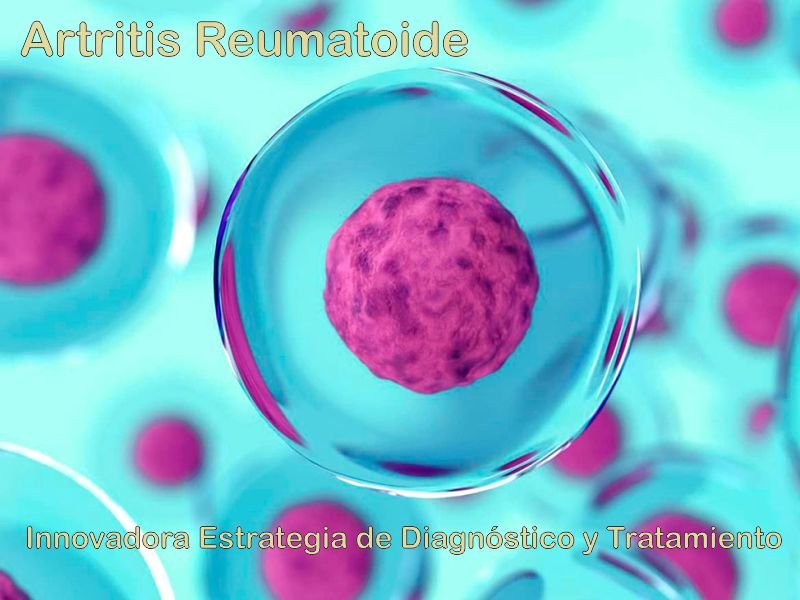 Innovadora Estrategia de Diagnóstico y Tratamiento de la Artritis Reumatoide
